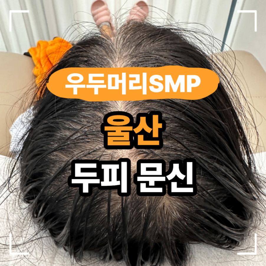 울산 남구 SMP 두피 문신 확인할 기준